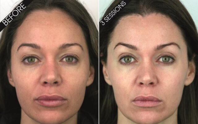 Customer Results